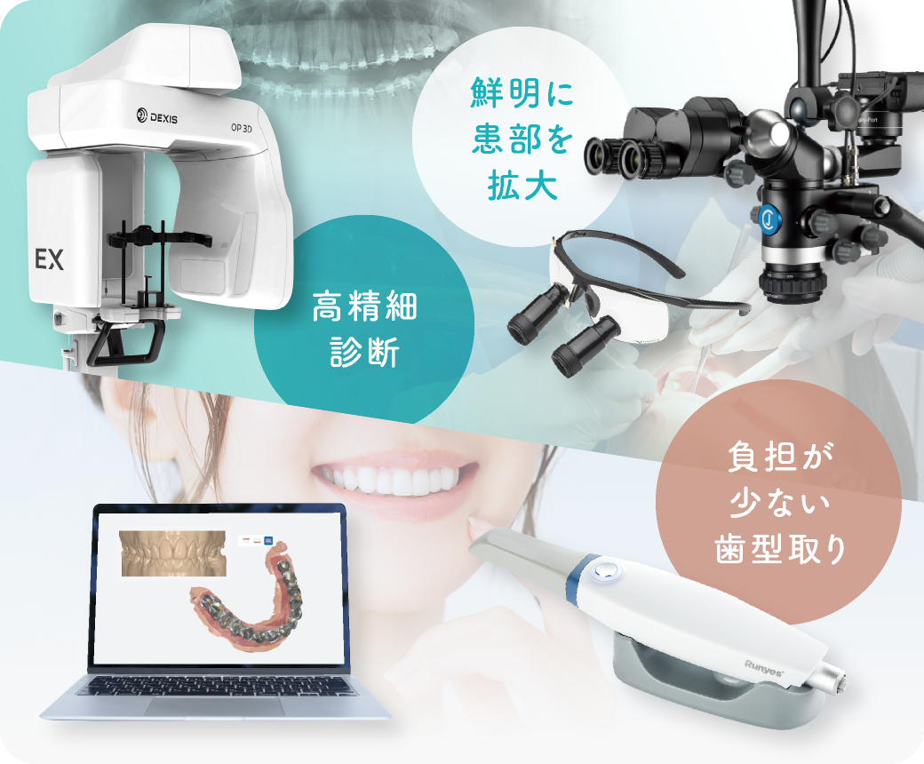02 鮮明に患部を拡大・高精細診断 負担が少ない歯型取り